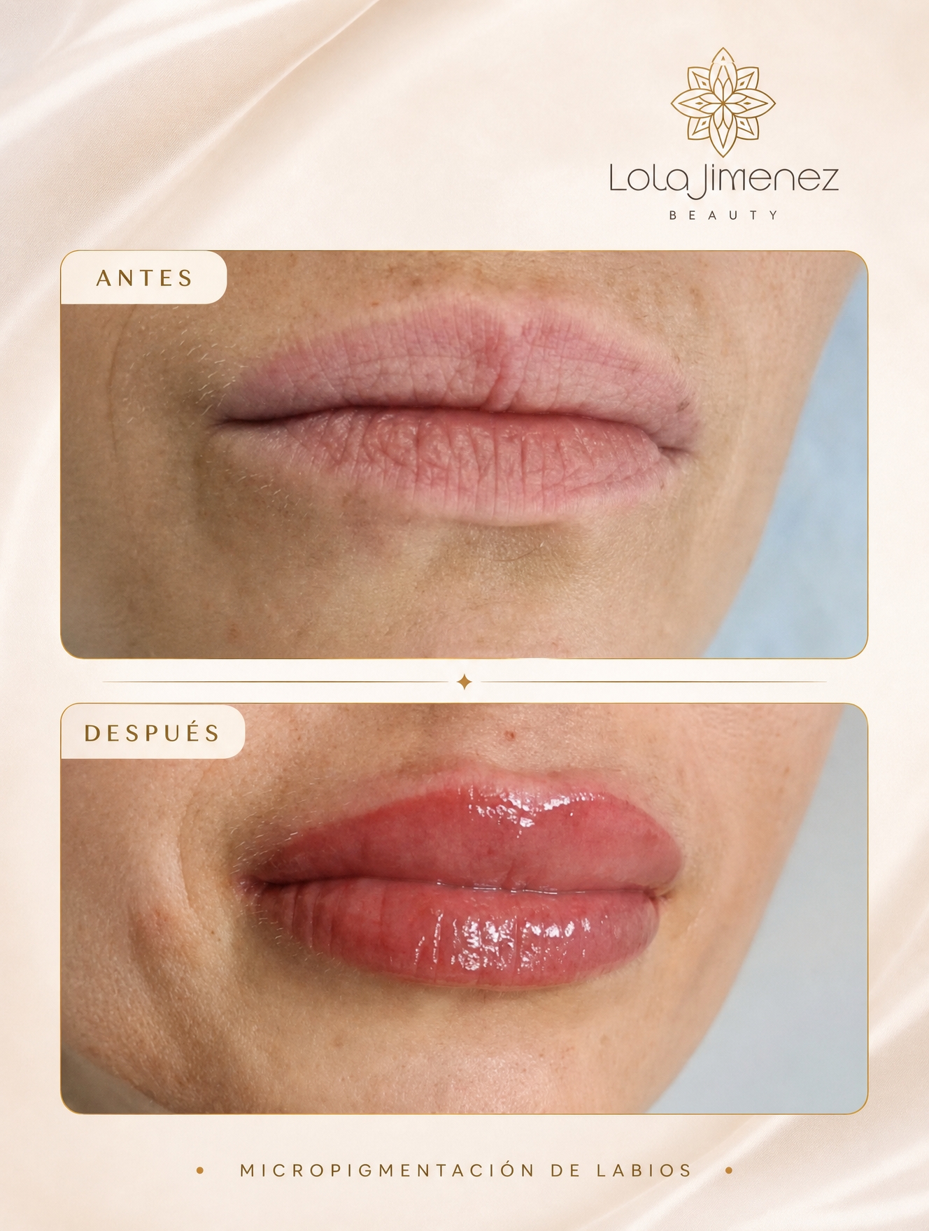 Resultado natural de micropigmentación de labios en Jaén