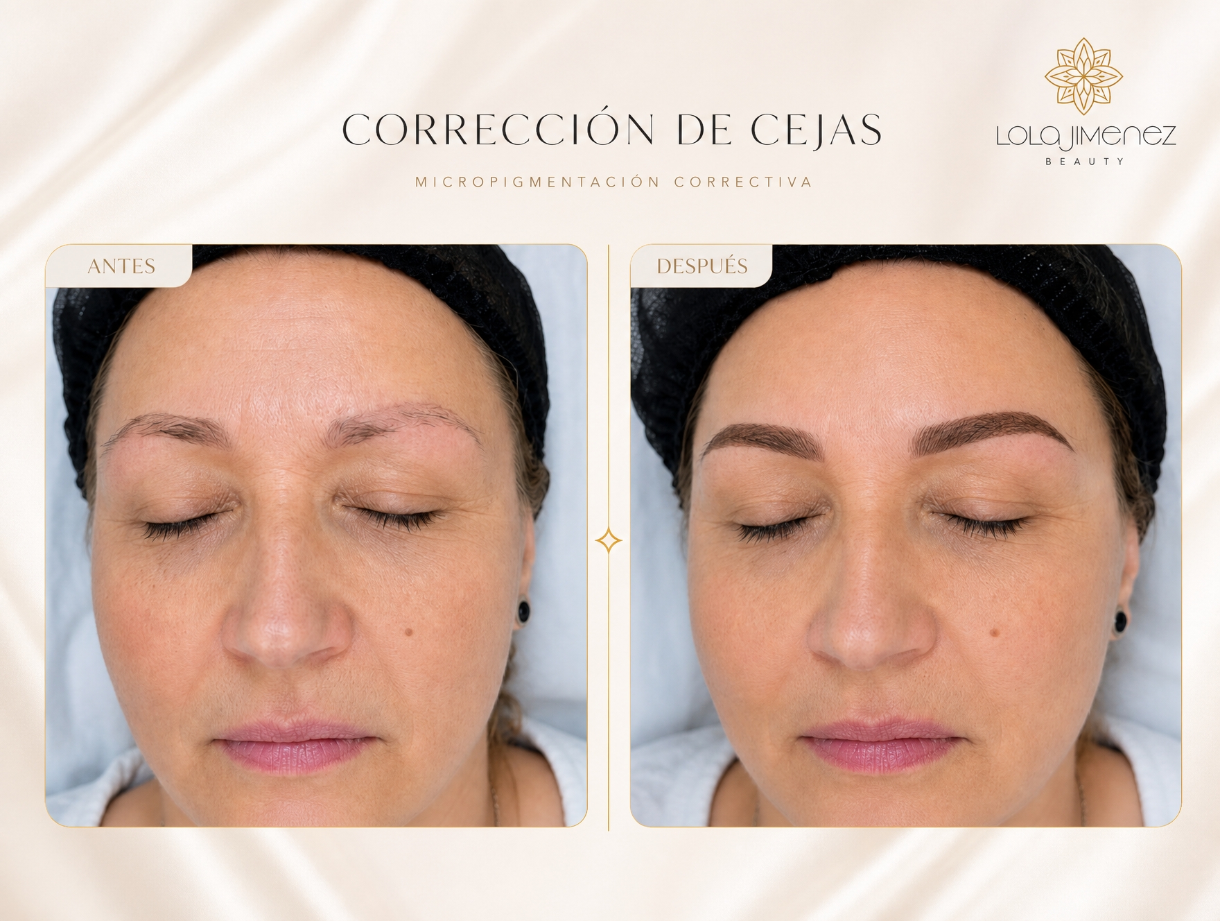 Shading — antes y después
