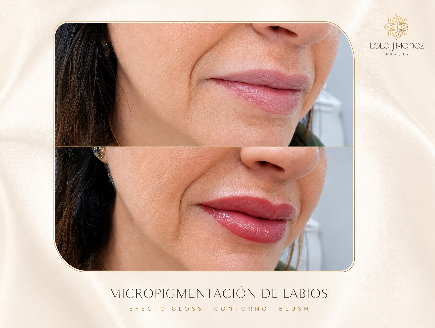 Labios